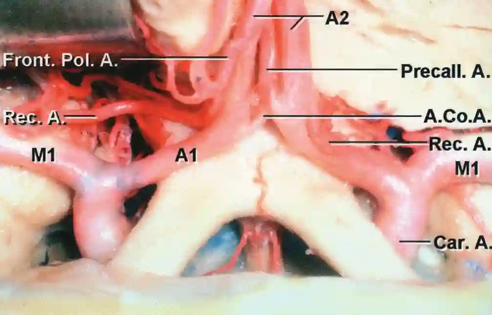 ACA A1 Segment