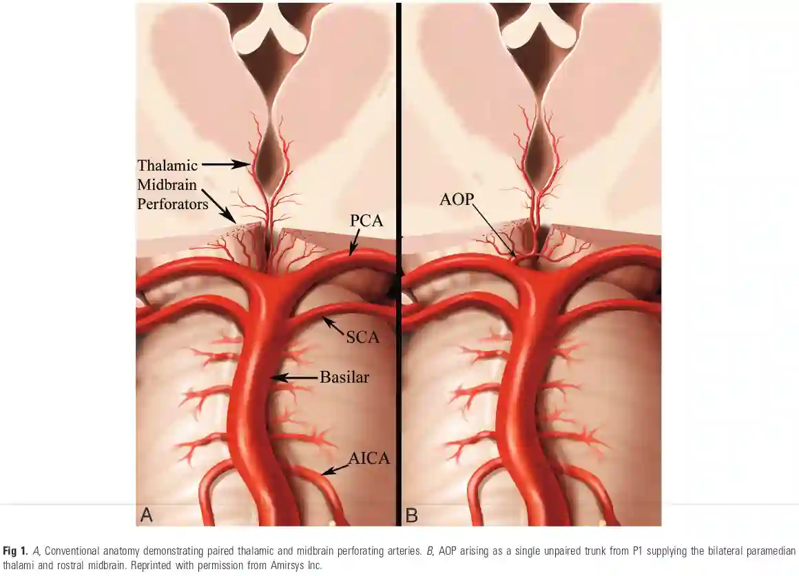 Arterie von Percheron