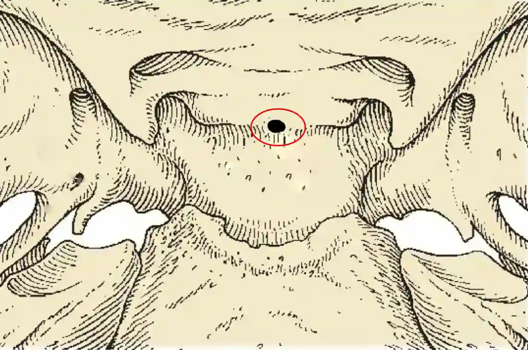 Canalis craniopharyngeus