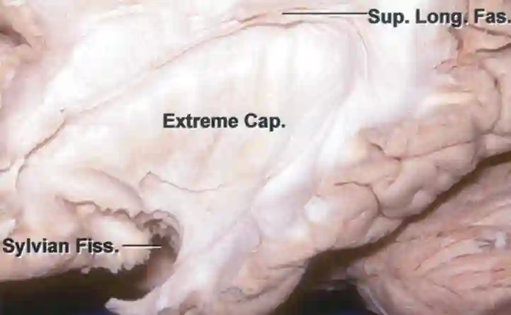 Capsula extrema Rhoton Abbildung