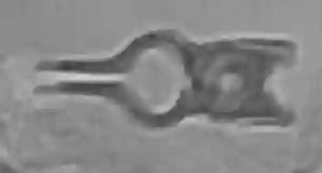 Lazic Aneurysmaclip