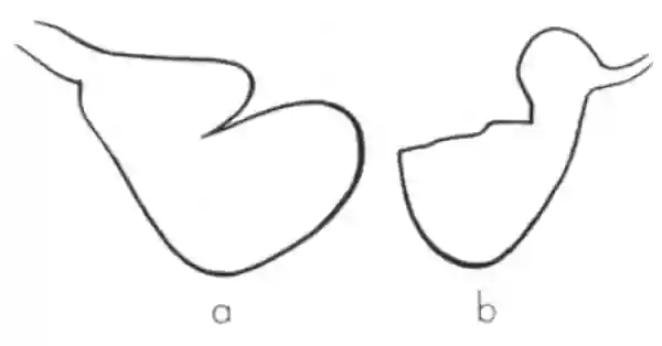Schematische Darstellung der intrkaniellen und extrakraniellen Form des Foramen jugulare