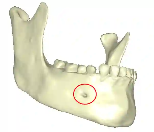 Foramen mentale Abbildung