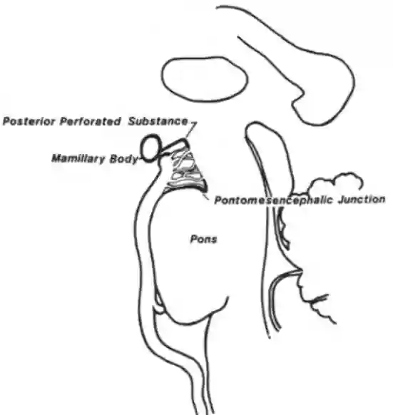 Fossa interpeduncularis schematisch