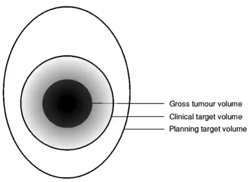 Gross tumour volume (GTV)
