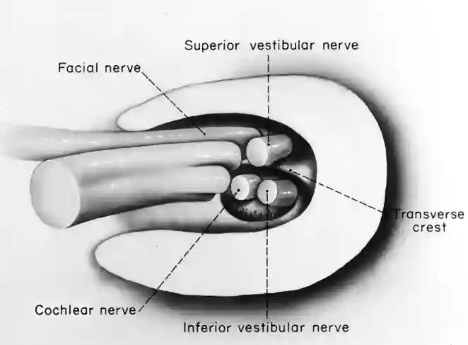 Schematische Darstellung der anatomischen Strukturen im Meatus acusticus internus