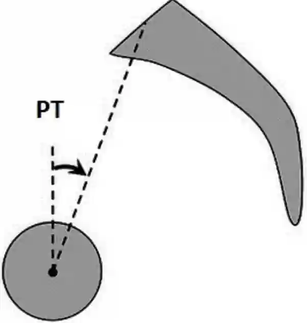 Pelvic Tilt (PT)