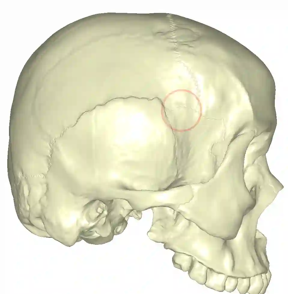 Pterion Schädel