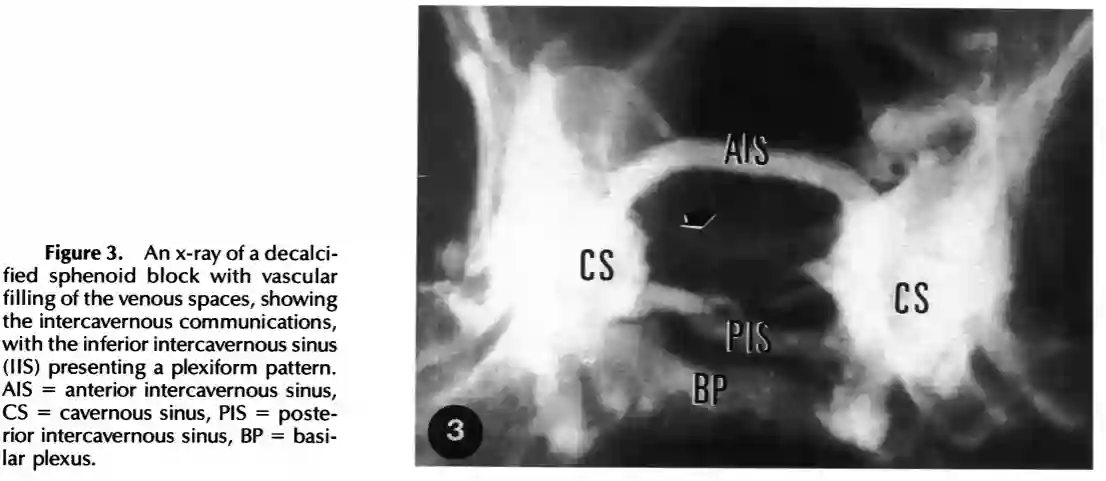 Abbildung Sinus intercavernosus