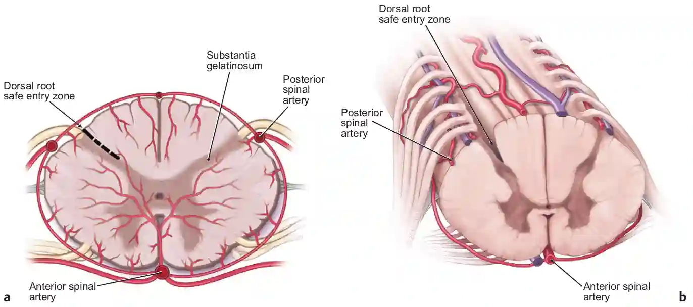 Safe Entry Zone Dorsal Root