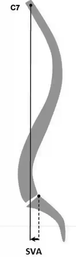 Schematische Darstellung der SVA
