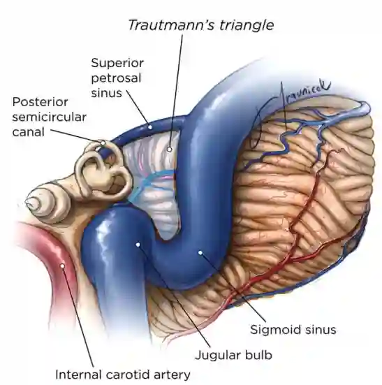 Schematische Darstellung des Trautmann Triangel